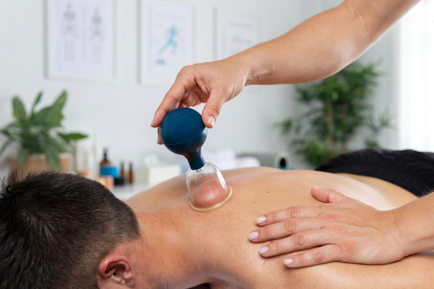cupping therapy